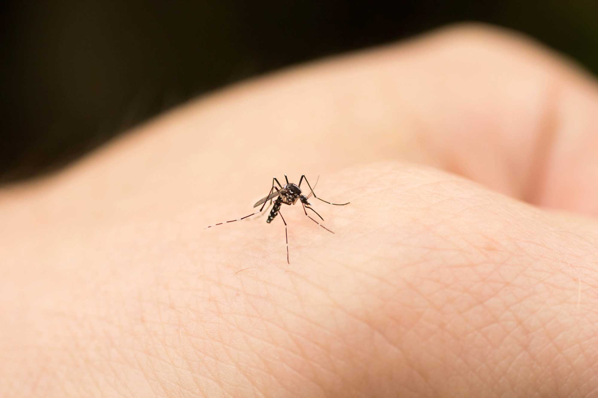 La alergia a las picadura de mosquitos, Sindrome de Skeeter